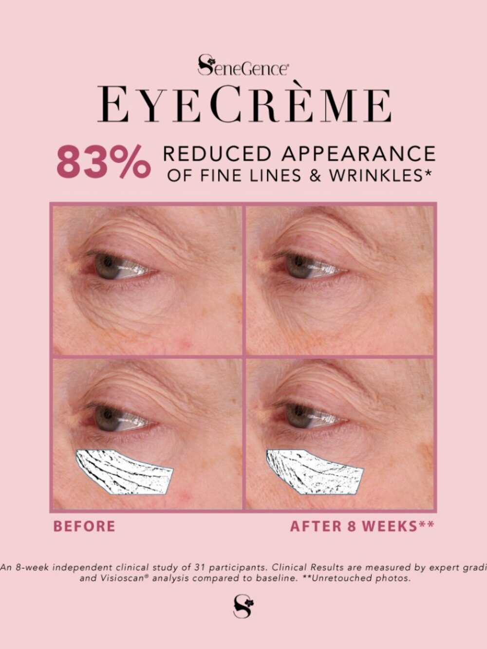 EyeCreme - Picture 6 of 7